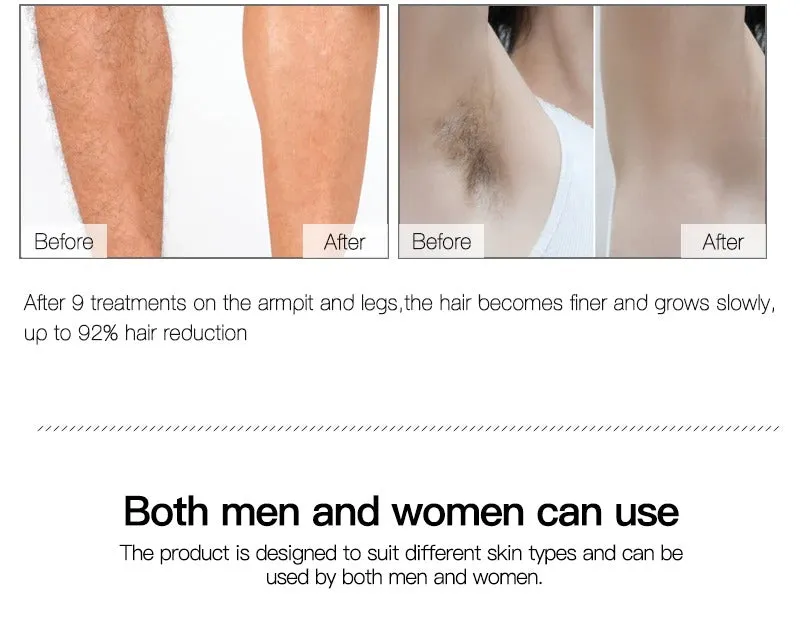 At Home Laser Hair Removal Permanent Hair Removal Device