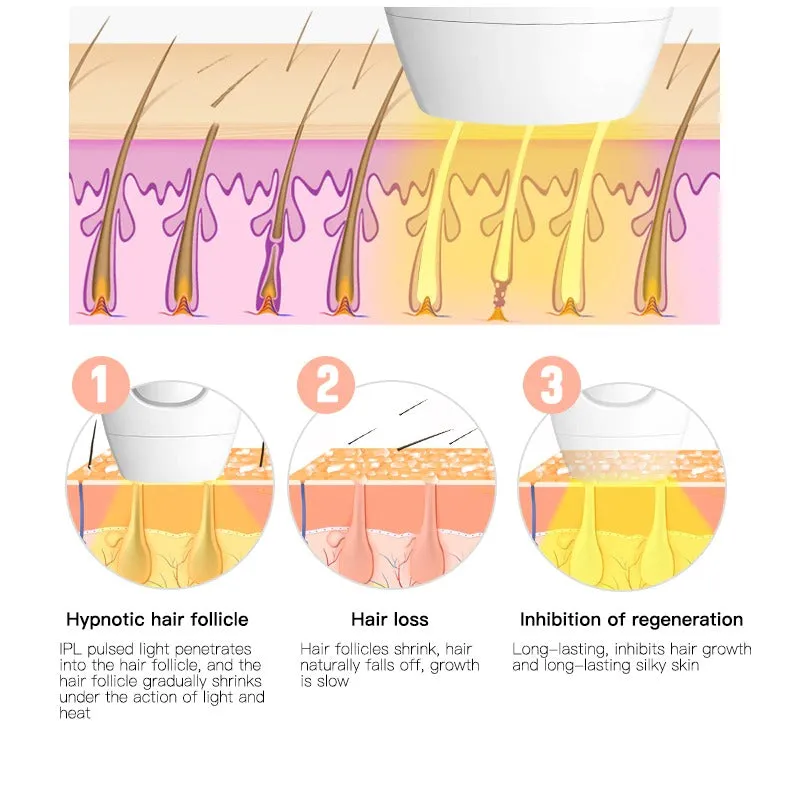 At Home Laser Hair Removal Permanent Hair Removal Device
