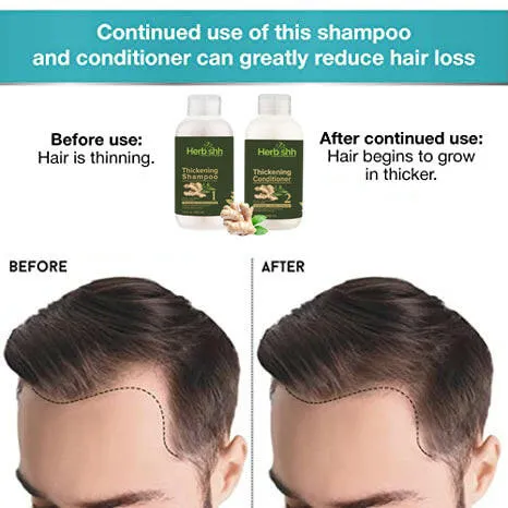 Buy Thick Set and get free Hair Mask - Herbishh