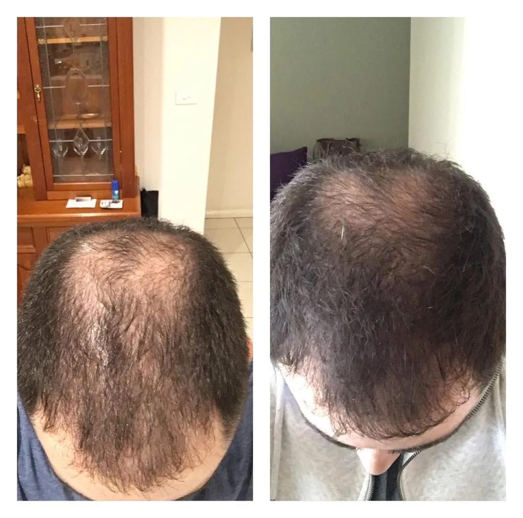 Hair Growth Spray