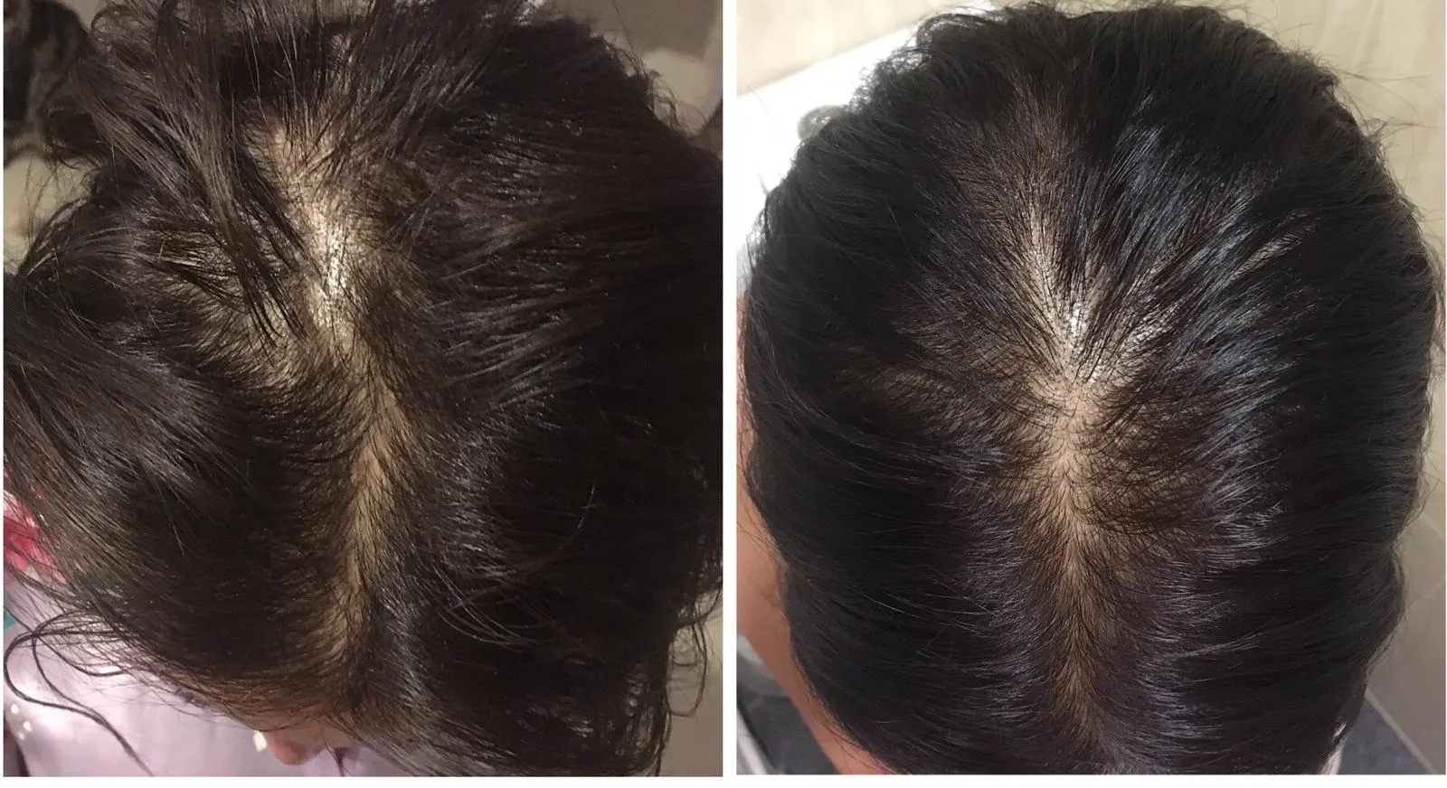 Hair Growth Spray