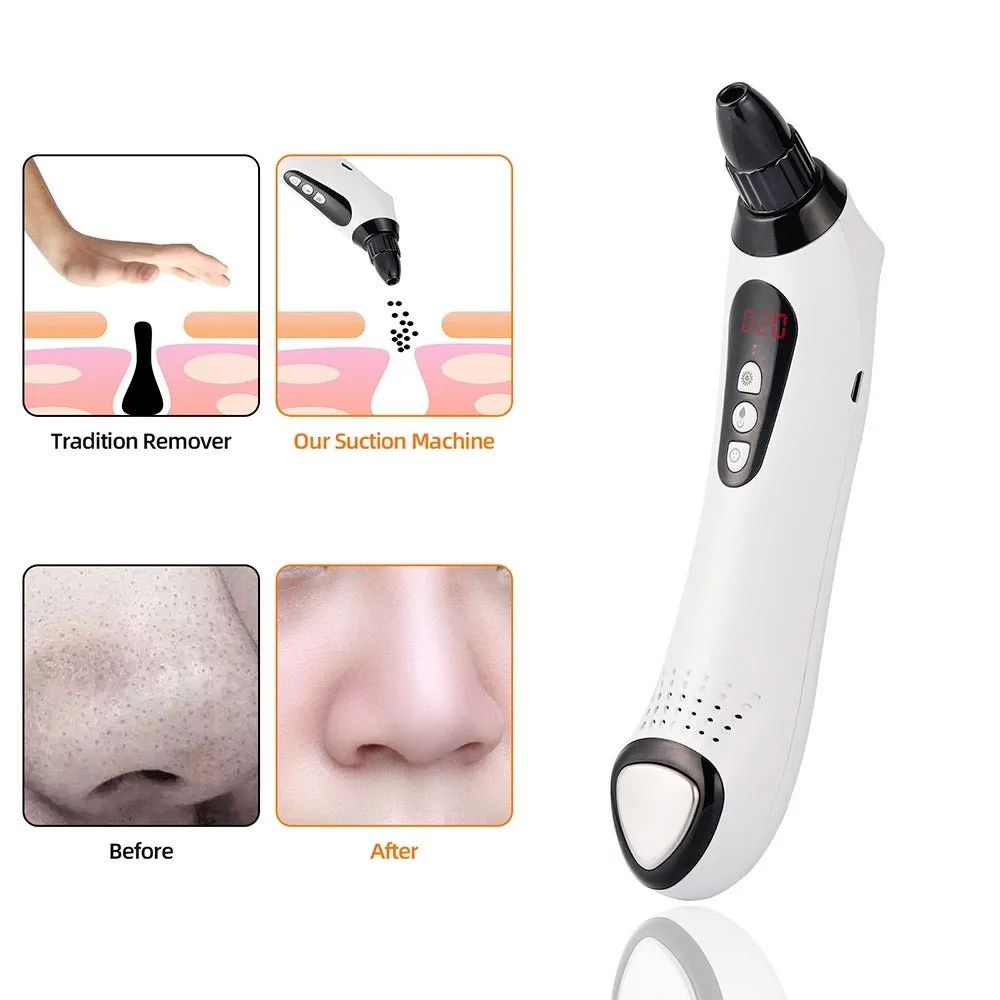Vacuum Suction Skin Care Pore Deep Cleansing Acne Pimple Blachead Remover