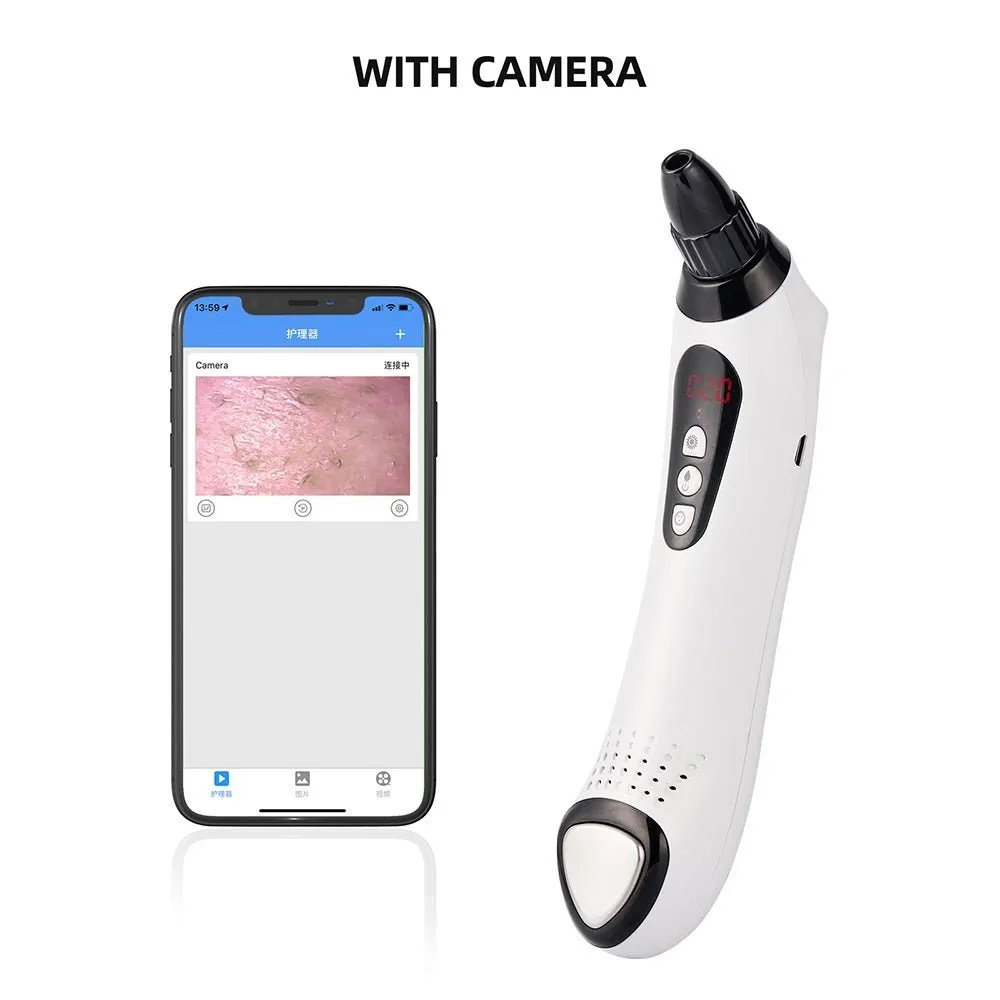 Vacuum Suction Skin Care Pore Deep Cleansing Acne Pimple Blachead Remover